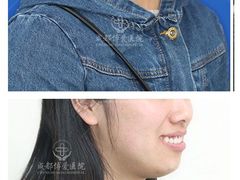 -团圆口腔·种植中心(锦江院区)