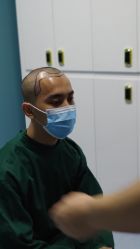 -大麦微针植发全国连锁