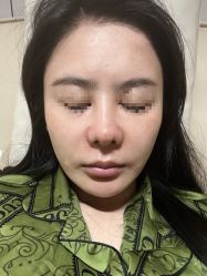 体验后-上海首尔丽格医疗美容医院