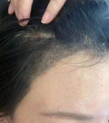 -熙朵美学植发·连锁品牌