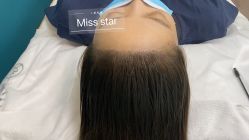 -MISS STAR·半永久纹眉·发际线·美瞳线