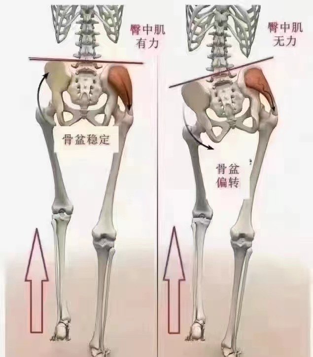 儿麻长短腿图片