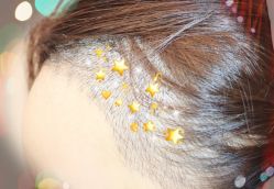 -大麦微针植发全国连锁