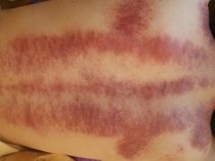 -百玺推拿·SPA·瑶浴(万象店)