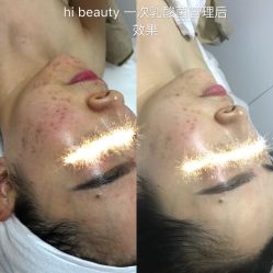-Hi Beauty Skin 科技美肤中心