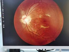 -宝岛眼镜(苏州浒关店)