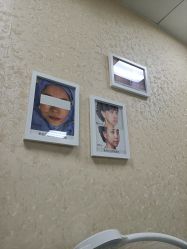 -成都西区医院整形美容