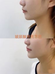 -上海漾颜医疗美容