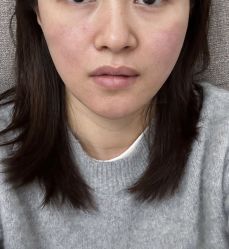 -Yestar艺星整形美容医院