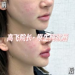 -深圳艺星医疗美容医院