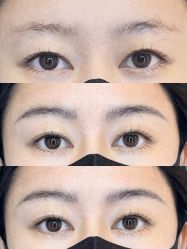 点击看大图 -杨益美学·野生眉半永久纹眉发际线