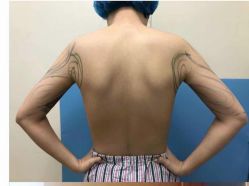 -洁铭新加坡医美