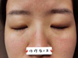 -铂诗玥医美
