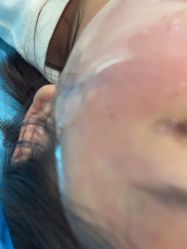 -素美医疗美容·西南眼鼻整形·修复基地
