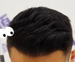 -大麦微针植发全国连锁