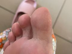 -新甲连锁灰指甲·甲沟炎·修脚(爱联店)