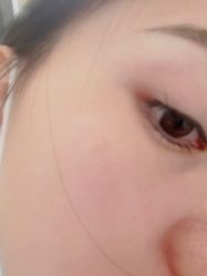 -丽美妍医疗美容·皮秒·立体分层抗衰