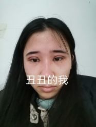 体验后-广州美莱医疗美容医院