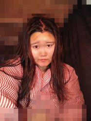点击看大图 -禾美嘉医疗美容