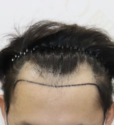 -熙朵美学植发·连锁品牌