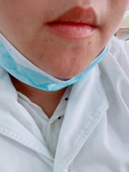 体验后-东莞台心医院-医疗美容