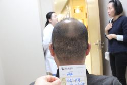 点击看大图 -大麦微针植发丨全国连锁