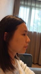 -Yestar杭州艺星医疗美容医院