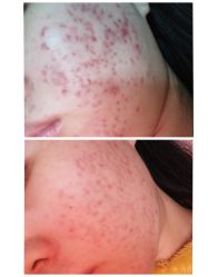 -痘院士专业祛痘皮肤管理