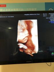 -杭州贝瑞斯美华妇儿医院·早孕·产检·儿科