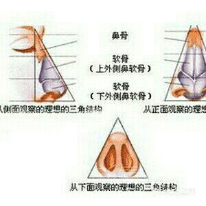 听说隆完鼻👃,不能🙅捏鼻子是真的吗?