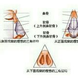 听说隆完鼻👃,不能🙅捏鼻子是真的吗?