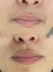 -美愈美肤MEIYU SKIN