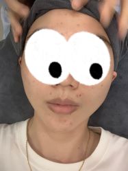 点击看大图 体验前-天河爱来医疗美容门诊部
