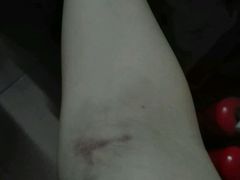 -广州市红十字会医院(总院)