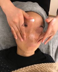 -溢美古法抗衰