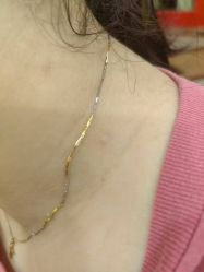 -北京美痣堂古方祛痣斑疣瘊