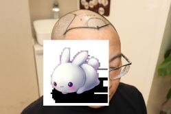 -大麦微针植发丨全国连锁