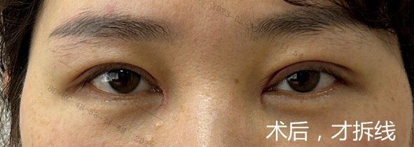 -美莱医学美容医院