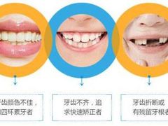 -团圆口腔·种植中心(锦江院区)