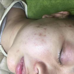 点击看大图 -苗方清颜痘肌研究所