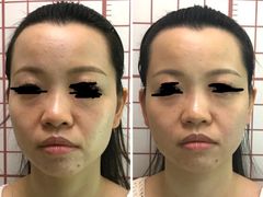 -修申骨雕小颜脊柱骨盆管理产后修复