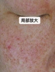 点击看大图 -睿明真达专业皮肤护理中心