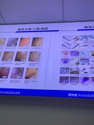 -蕾特恩专业祛痘