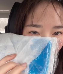 体验后-美安心医美·美迪迈黄金微针·美拉美医疗美容