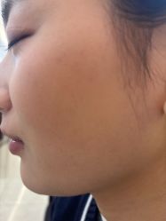 -长沙雅美医疗美容医院