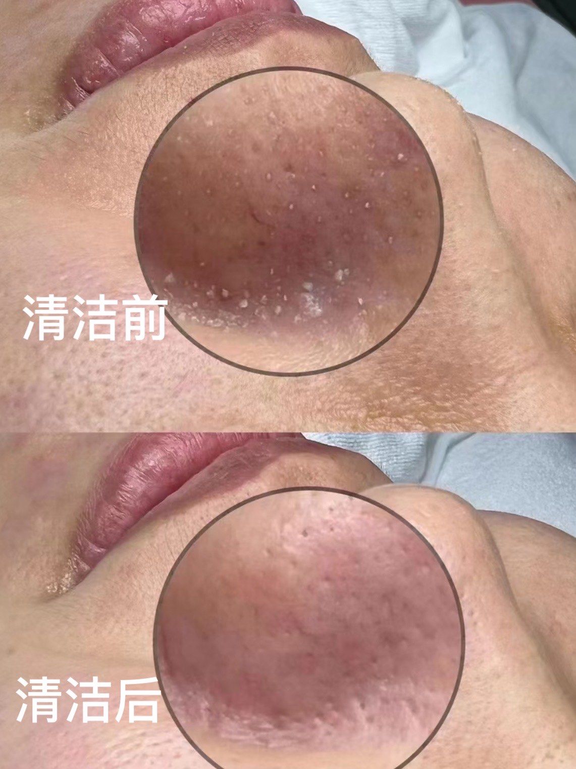 为什么长黑头
