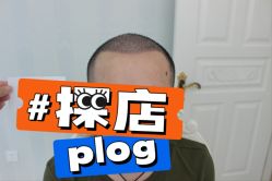 -大麦微针植发丨全国连锁