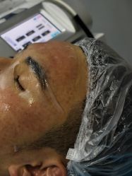 -长沙雅美医疗美容医院