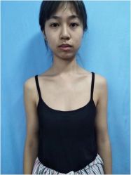 点击看大图 -南昌臻爱医疗美容