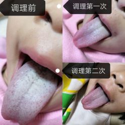 -福润堂小儿推拿保健中心(北京密云店)